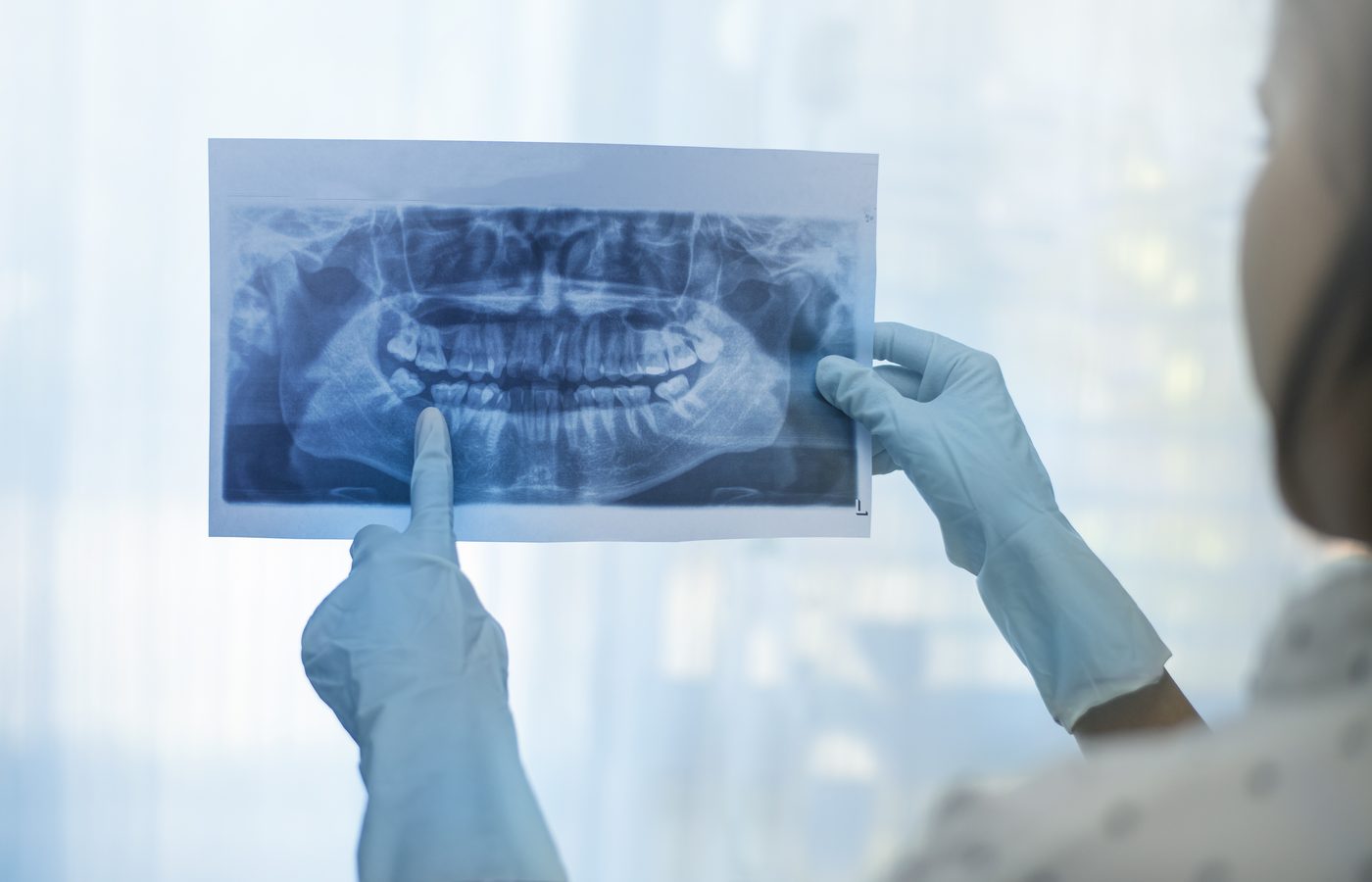Dentiste examinant une radiographie dentaire