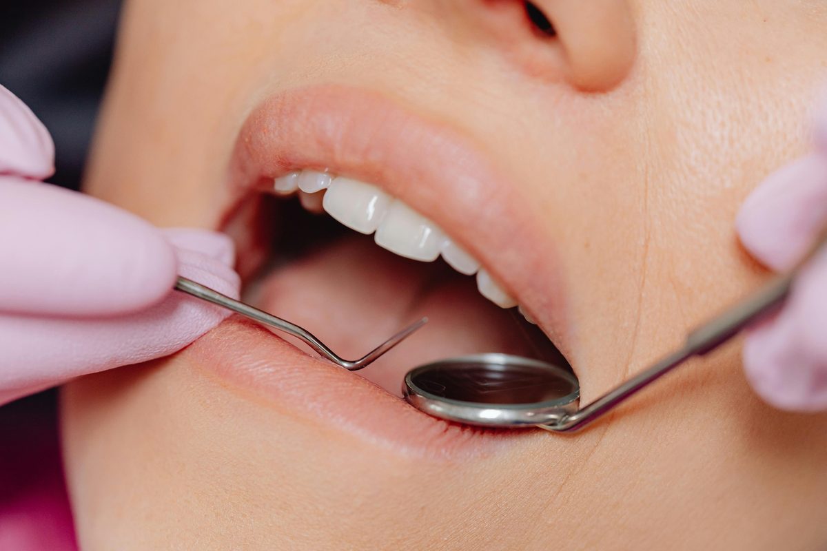 Patient souriant après des soins dentaires